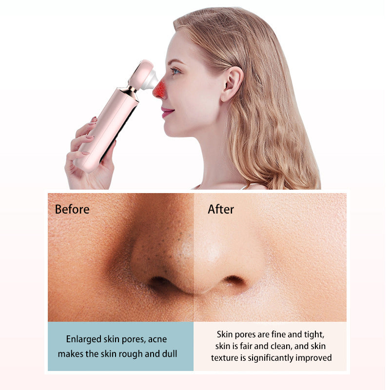 Visual electric pore cleaner